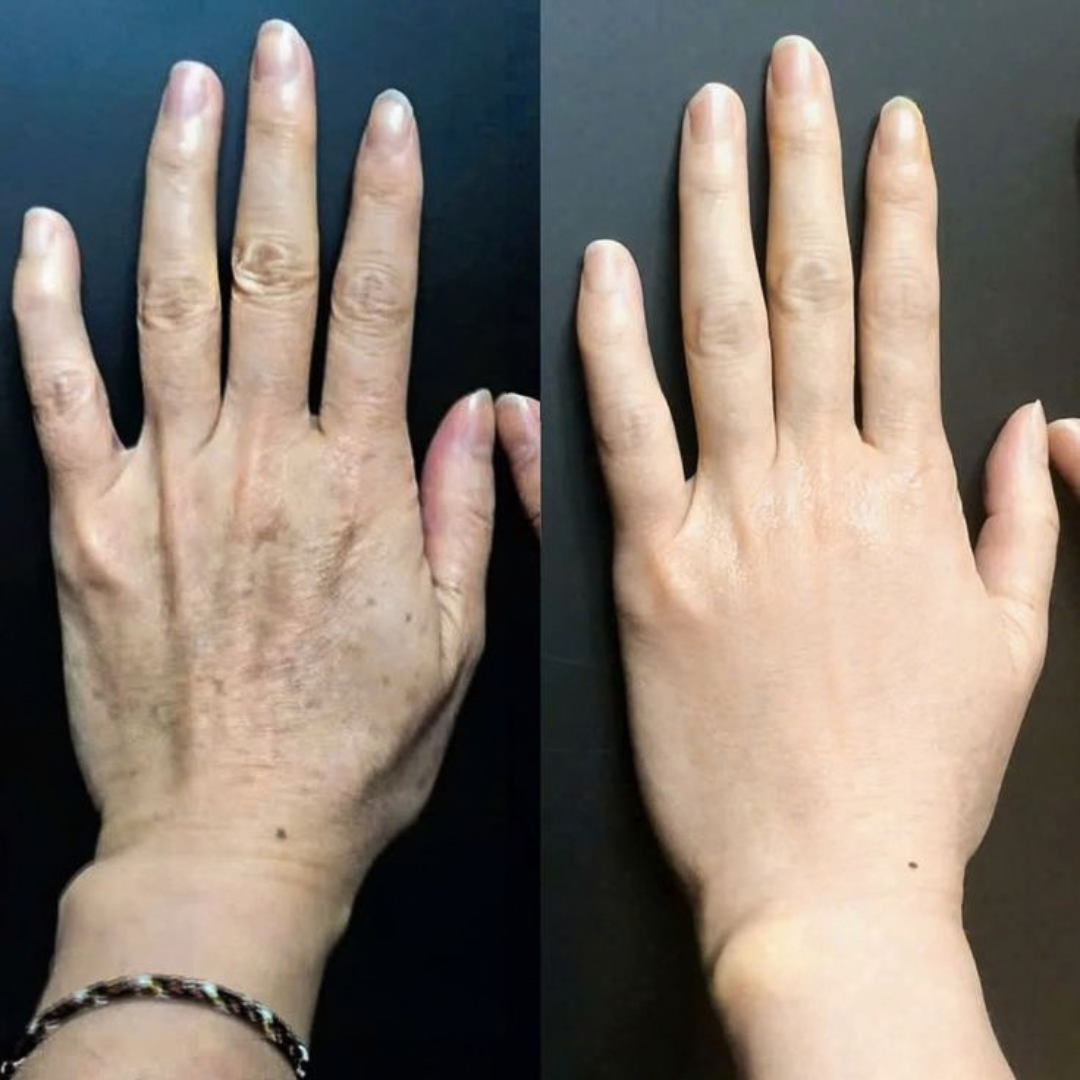 Αποτέλεσμα περιποίησης χεριών 2